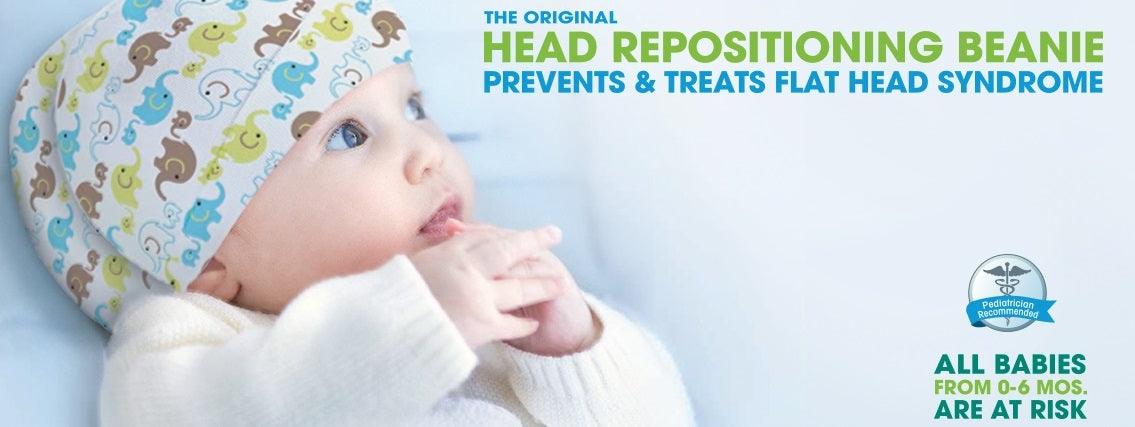 What is Flat Head Syndrome - Goldtex