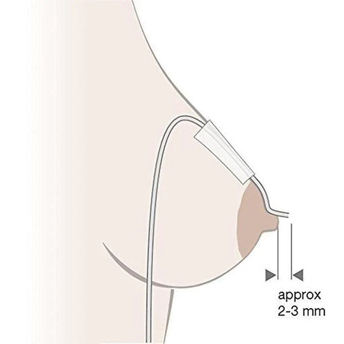 Medela® - Medela Supplemental Nursing System (SNS) - for Special Needs - Premature - Latching issues