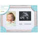 Pearhead® - Pearhead Rustic Sonogram, Bracelet & Photo Frame